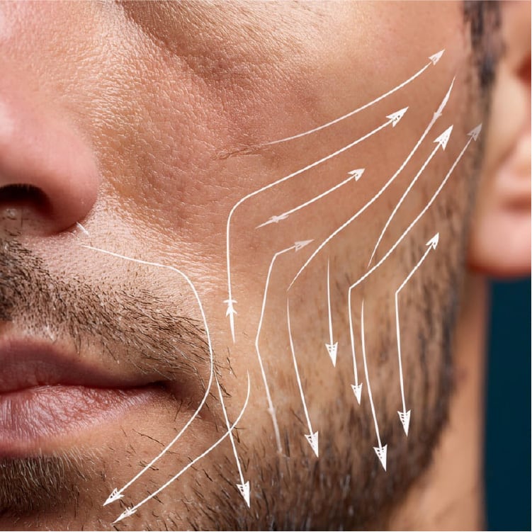 Fotografia mostrando la barba de un hombre y hacia donde van sus arrugas